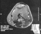 Zoom image: Radiological image