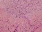 Zoom image: Cell stain