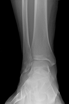 Zoom image: Radiological image