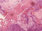 Zoom image: Cell stain