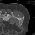Zoom image: Radiological image