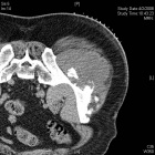Zoom image: Radiological image