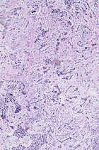 Zoom image: Cell stain
