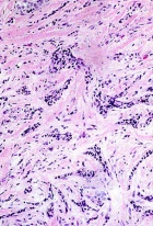 Zoom image: Cell stain