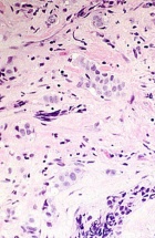 Zoom image: Cell stain