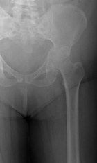 Zoom image: Radiological image