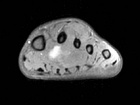 Zoom image: Radiological image