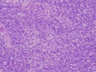 Zoom image: Cell stain