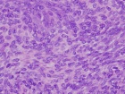 Zoom image: Cell stain