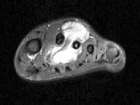 Zoom image: Radiological image