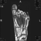 Zoom image: Radiological image