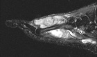 Zoom image: Radiological image
