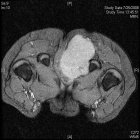 Zoom image: Radiological image
