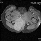 Zoom image: Radiological image
