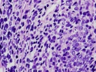 Zoom image: Cell stain