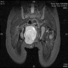 Zoom image: Radiological image