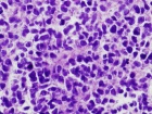 Zoom image: Cell stain
