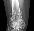 Zoom image: Radiological image