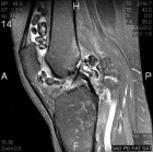 Zoom image: Radiological image