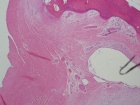 Zoom image: Cell stain