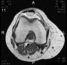 Zoom image: Radiological image