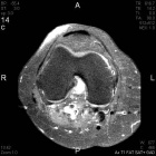 Zoom image: Radiological image