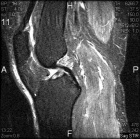 Zoom image: Radiological image