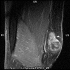 Zoom image: Radiological image