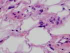Zoom image: Cell stain
