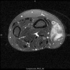 Zoom image: Radiological image