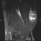 Zoom image: Radiological image