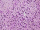 Zoom image: Cell stain