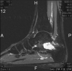 Zoom image: Radiological image