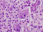 Zoom image: Cell stain