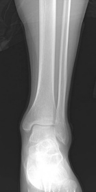 Zoom image: Radiological image