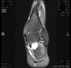Zoom image: Radiological image