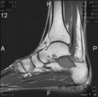 Zoom image: Radiological image