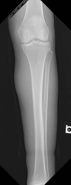 Zoom image: Radiological image