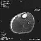 Zoom image: Radiological image