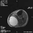 Zoom image: Radiological image