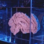 Human brain suspended in preservative. 