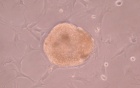 Image of a pancreatic islet cell.