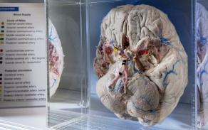 Brain in a glass case seen in the Brain Museum at the Jacobs School. 