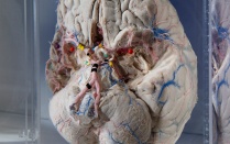A specimen on display at the Brain Museum. 