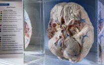 brain display in Brain Museum. 