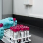 A person holds samples for a clinical trial. 