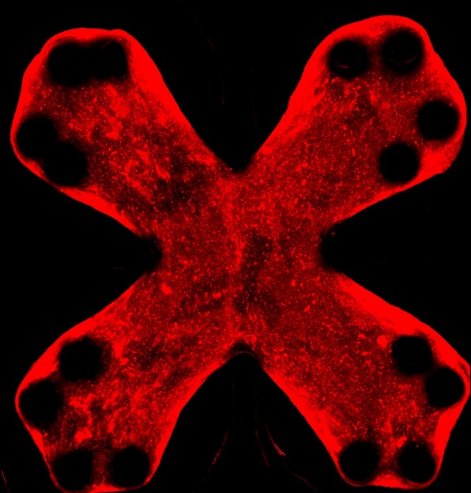 Microscopic view of collagen in lung tissue. 